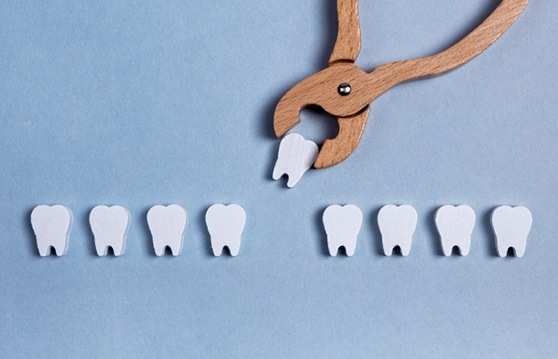 Illustrated clasp grabbing a tooth from a row of teeth
